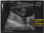 echo15aout_09.jpg
