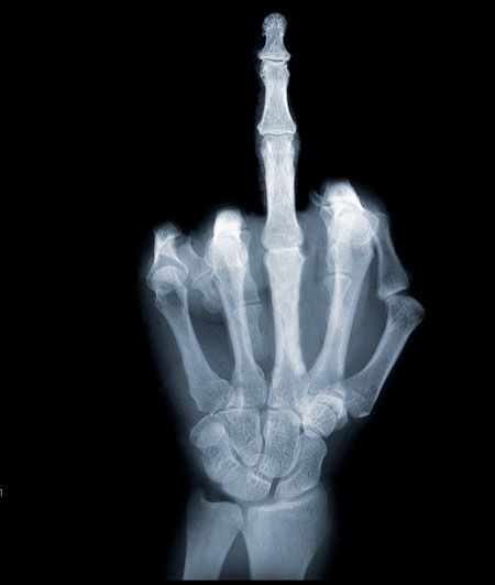 nick veasey 1 nick veasey 1