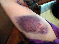 Is that gross or what?
