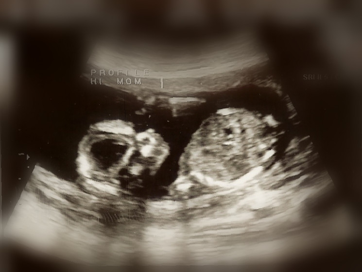 [15w+profile+blurred.jpg]
