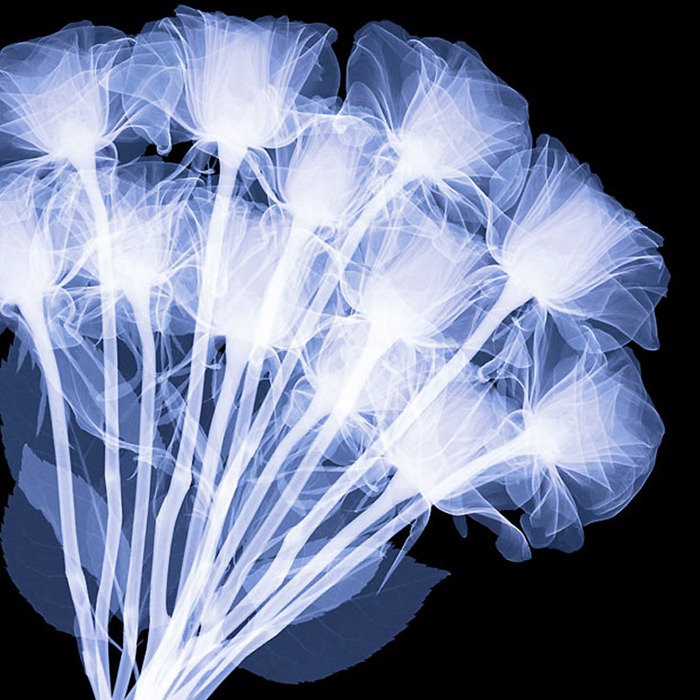 X Ray Flowers...***EXCLUSIVE***
UNSPECIFED - UNDATED: X-ray of a bunch of 12 roses.
These mesmerising shots are the fruit of years of careful experimentation by artist Hugh Turvey, using x-rays to really get under the surface of things. The technique, which came about thanks to a chance commission from a musician friend who wanted an x-ray image, has been 14 years in the making and has now been so well honed by Hugh that his work is becoming highly sought after. The flowers are the latest in a long line of subjects, including motorbikes, suitcases and stiletto-clad feet.
PHOTOGRAPH BY SPL / BARCROFT MEDIA LTD
UK Office, London.
T +44 845 370 2233
W www.barcroftmedia.com
USA Office, New York City.
T +1 212 564 8159
W www.barcroftusa.com
Indian Office, Delhi.
T +91 114 653 2118
W www.barcroftindia.com
Australasian & Pacific Rim Office, Melbourne.
E info@barcroftpacific.com
T +613 9510 3188 or +613 9510 0688
W www.barcroftpacific.com X Ray Flowers...***EXCLUSIVE***
UNSPECIFED - UNDATED: X-ray of a bunch of 12 roses.
These mesmerising shots are the fruit of years of careful experimentation by artist Hugh Turvey, using x-rays to really get under the surface of things. The technique, which came about thanks to a chance commission from a musician friend who wanted an x-ray image, has been 14 years in the making and has now been so well honed by Hugh that his work is becoming highly sought after. The flowers are the latest in a long line of subjects, including motorbikes, suitcases and stiletto-clad feet.
PHOTOGRAPH BY SPL / BARCROFT MEDIA LTD
UK Office, London.
T +44 845 370 2233
W www.barcroftmedia.com
USA Office, New York City.
T +1 212 564 8159
W www.barcroftusa.com
Indian Office, Delhi.
T +91 114 653 2118
W www.barcroftindia.com
Australasian & Pacific Rim Office, Melbourne.
E info@barcroftpacific.com
T +613 9510 3188 or +613 9510 0688
W www.barcroftpacific.com