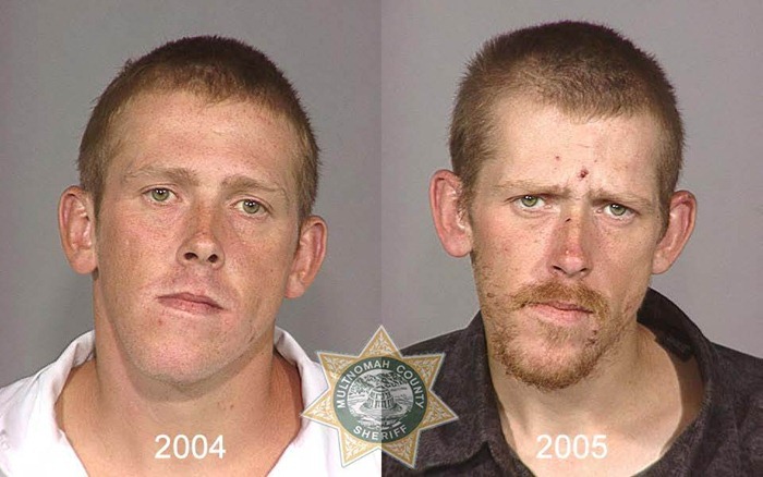 shocking pictures show consequences of drug use amusing shocking pictures show consequences of drug use amusing