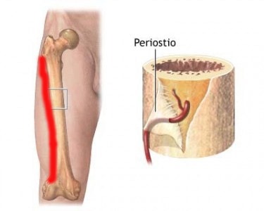 [periostitis tibial en padel[7].jpg]