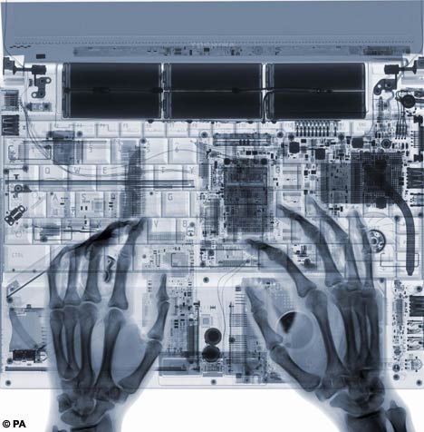[xray_PC[2].jpg]