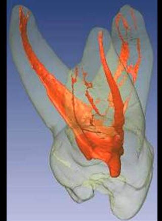 [RootCanalSystem8.jpg]