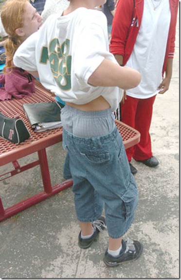 baggypants