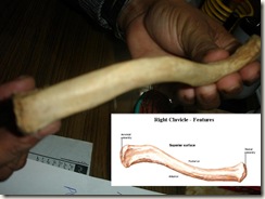 clavicle; medial end of clavicle has complete fusion, above 25 years