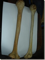 left male humerus &  right humerus (female) with hole in trochlea 2