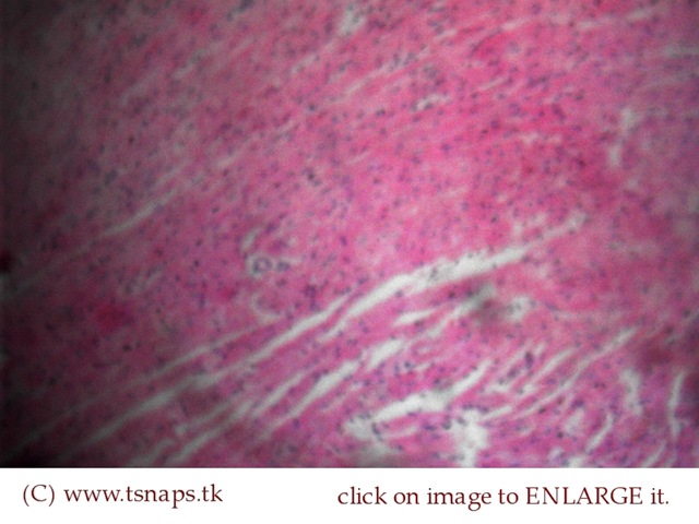 [Cardiac Muscle2 histology slide[2].jpg]
