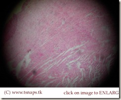 Cardiac muscle histology slide Cardiac muscle histology slide