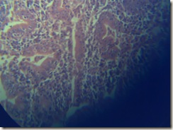 Purkinje cells 2 histology slide