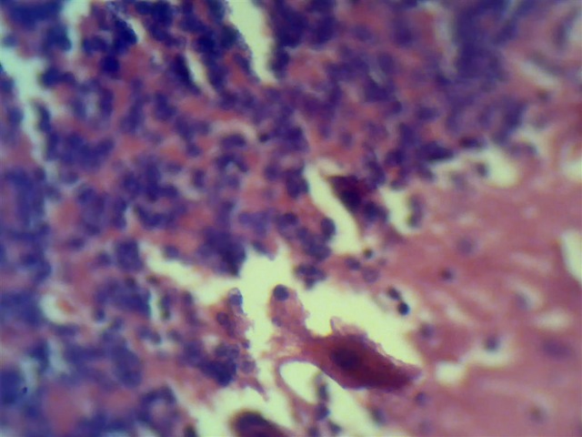 [purkinje cells histology slide[2].jpg]