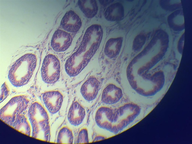 [Stereocilia microscope view[2].jpg]