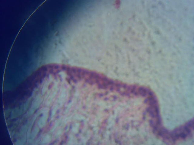 [Stratified columnar epithelium under microscope[2].jpg]