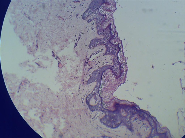 [Stratified squmous keratinized epithelium microscope view[2].jpg]