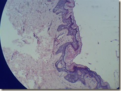 Stratified squmous keratinized epithelium microscope view