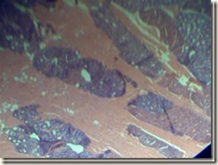 Mucous(purple) serous(pink) histology slide_thumb