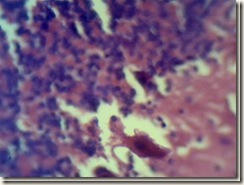 purkinje cells histology slide_thumb