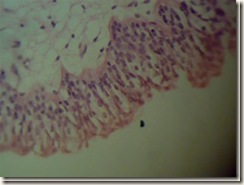Transitional epithilium under microscope_thumb