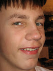 Vaseline Nose Part II