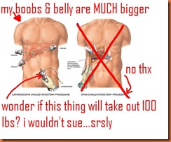 laparoscopic1