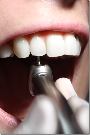 broca do dentista