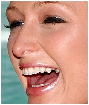 [paris hilton tooth[4].jpg]