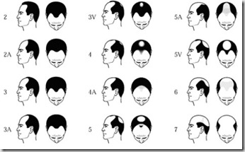 0009 malebaldness 0009 malebaldness