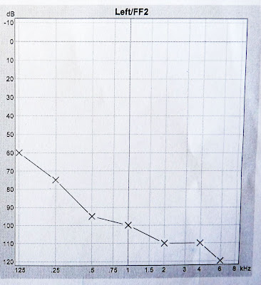 audiogram%20left.jpg