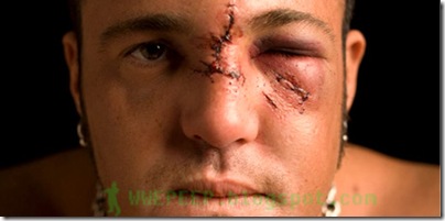 5 Joey Mercury 5 Joey Mercury
