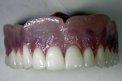 Natural Looking Dentures - Page 8 - Dental Lab Network