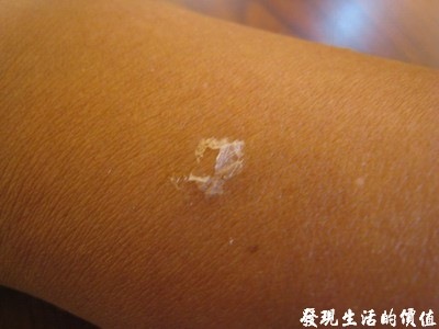 [sunburn01[2].jpg]