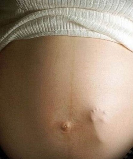 [embarazada-pie[3].jpg]