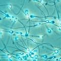 [spermatozoi[2].jpg]