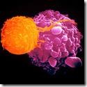 cancer