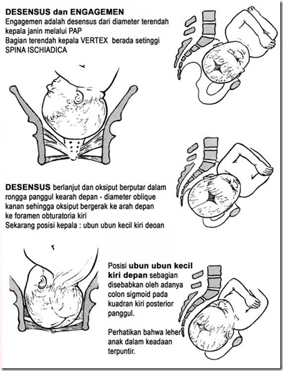 Cara ampuh meninggikan badan kalsium peninggi badan