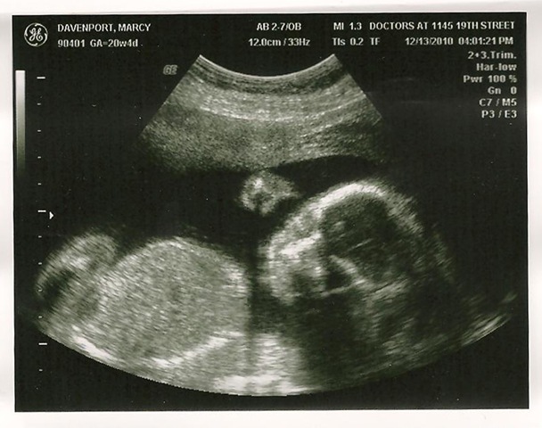 [baby 20 weeks 6[2].jpg]