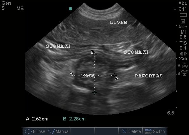 insulinoma in dogs nvi east veterinary imaging abdominal canine insulinoma in dogs nvi east veterinary imaging abdominal canine