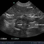 Pancreatic Insulinoma in a 10yo crossbreed dog