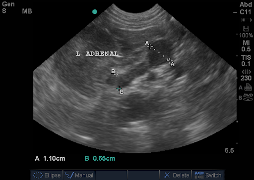 dog adrenal gland disease dog adrenal gland disease