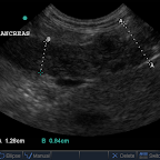 Pancreatitis in a 10yo Diabetic DSH