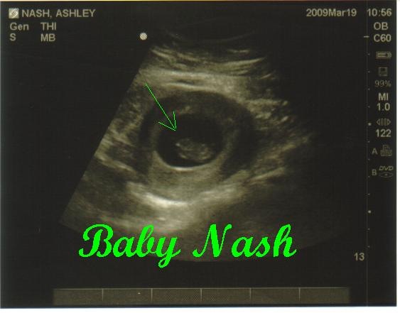 [Baby Nash[9].jpg]