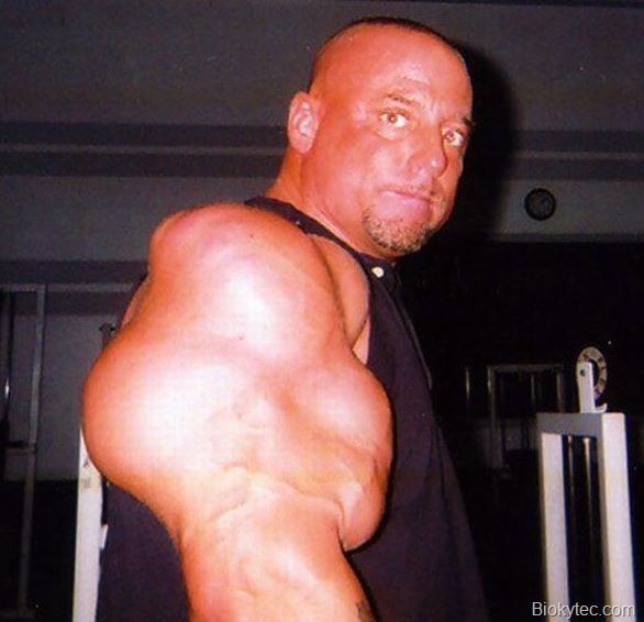 Musculos que dan asco - www.Biokytec.com-8 Musculos que dan asco - www.Biokytec.com-8