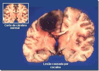 COCA COCA