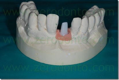 moncone ceramica integrale