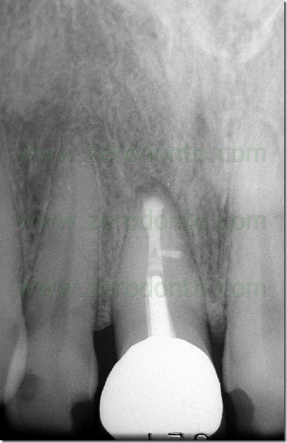 endodonzia endodonzia