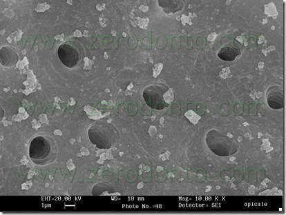 dentina canalare