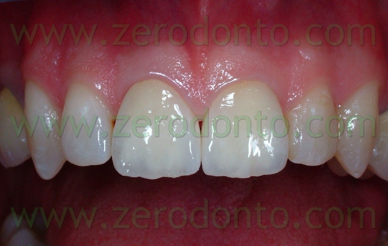 [ENTR CERAMICA[7].jpg]