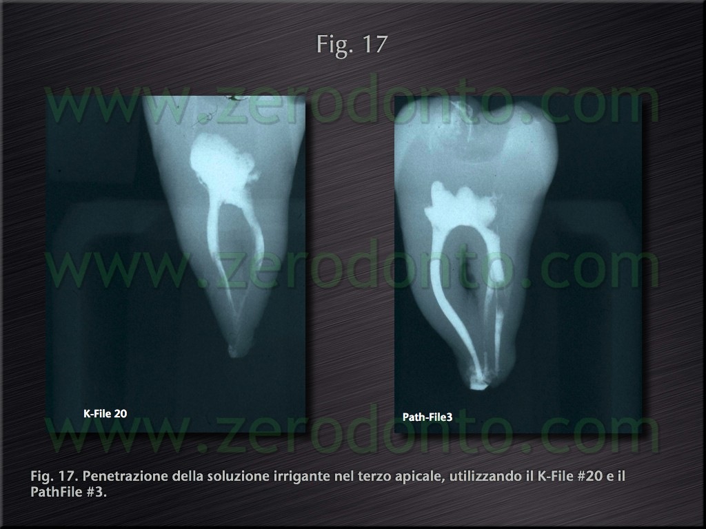 [Fig.17[4].jpg]