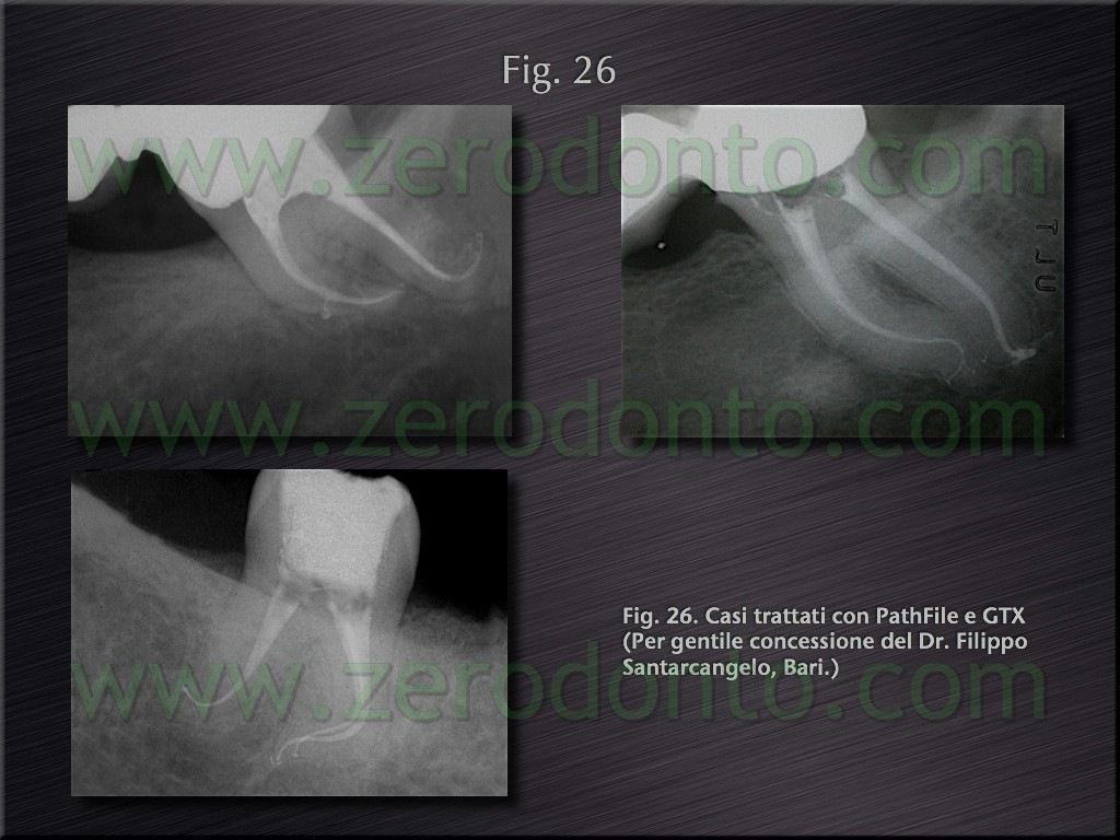 [Fig.26[4].jpg]